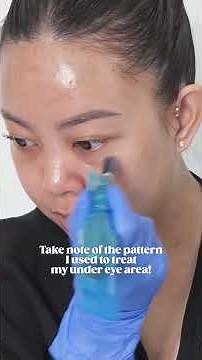 How to microneedle under eye area ✨