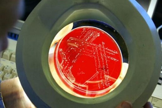 How staphylococcus aureus infections are contracted and treated