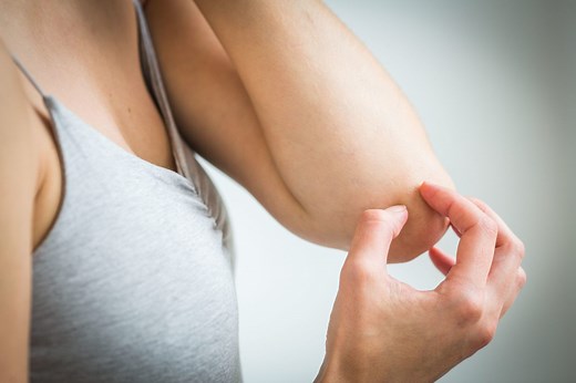 What To Know About Light Therapy for Atopic Dermatitis