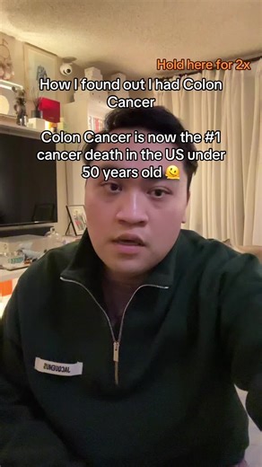 Understanding Colon Cancer: A Personal Journey