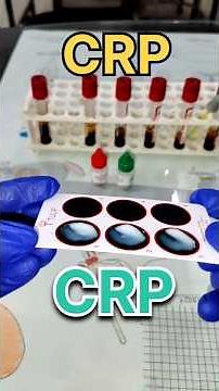 CRP blood test full procedure||#labtechnician #bloodtest #dmlt #pathology