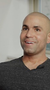 Omar tells us what he thinks about Scalp Micropigmentation | Skalp | Facebook