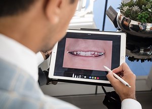 Full Mouth Reconstruction By Our Dentists - Bespoke Smile