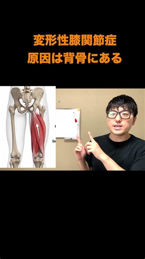 【変形性膝関節症】膝の痛みの黒幕は「背骨」にいた。解剖学で見るとこうなります#変形性膝関節症#膝の痛み