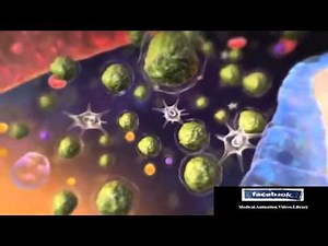Acute Lymphocytic Leukemia (ALL) Animation