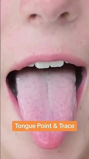 3 Tongue Stregthening Exercises to Use in Your Next Session