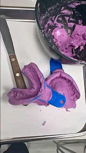 Alginate Impression - Lakes Dental Group