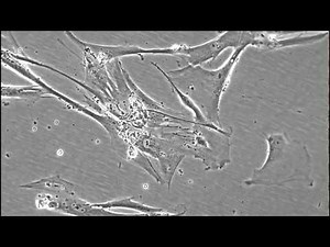 MCC5 fibroblasts in culture