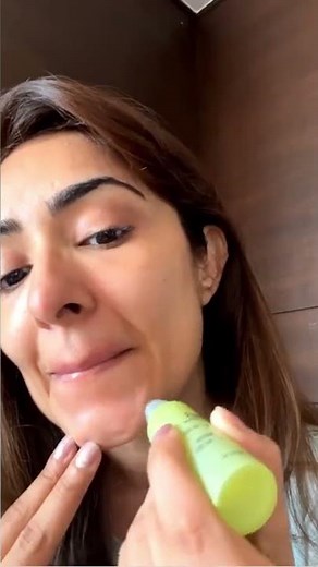 How to get rid of #milia at home by Face Yoga Expert #faceyogi Vibhuti Arora