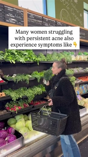 Many women struggling with persistent acne also experienced symptoms like ￼