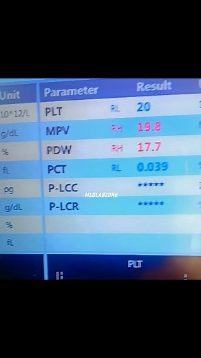 🍁 Platelet Clumping ( Pre Analytical : Clot or Partial Clot) 🍁 🍁 Pre-Analytical Cause: Collected Specimen in EDTA Tube 🔸 Failure to mix the blood immediately after collection. 🔸 Inadequate inversion (fewer than 8 times), leading to incomplete mixing of blood and anticoagulant → resulting in partial clot formation. 🍁 Effects🍁: 🔸 Causes Platelet Clumping. 🔸 Leads to falsely low platelet counts. 🔸 May result in erroneous CBC reports. 🍁 Recommendation🍁: After collecting blood into the ED
