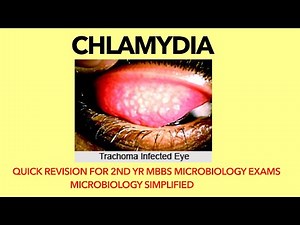Chlamydia | Microbiology | Bacteriology |Trachoma |Quick revision for 2nd yr MBBS microbiology exams