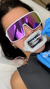 Installing a fresh set of gem teeth 🦷💎 | UNILAD Tech