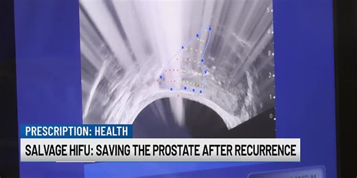 Salvage HIFU: Saving the Prostate After Recurrence