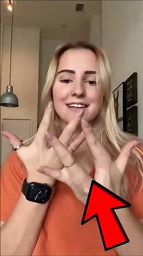 Lobster Feet and Hand Syndrome #Ectrodactyly