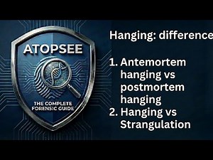 Hanging:Antemortem vs post mortem hanging,Hanging vs Strangulation.