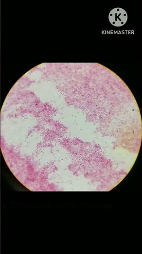 E. coli under microscope|E.coli bacteria |e.coli culture#microbiology#bacteria#science#science facts