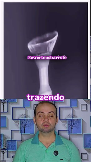 Discover what the first contact lenses were like.