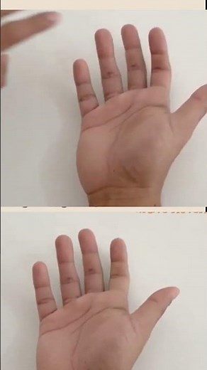 Explaining Grade 0 to 5 in Manual muscles testing. #anatomy #motivation #spinalcordinjury