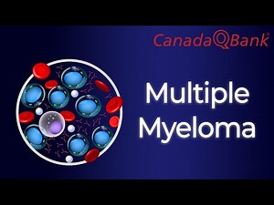 Multiple Myeloma