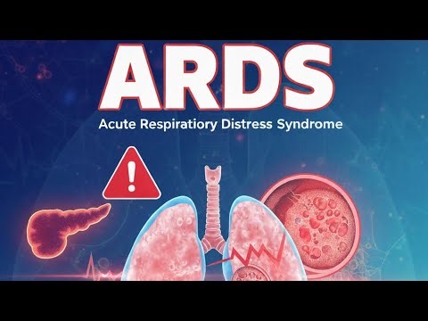 Acute Respiratory Distress Syndrome Causes, Pathophysiology And Management
