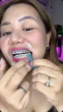 Braces care 101! 🦷✨ Here’s how to put elastics the right way! #bracestips #elasticbands