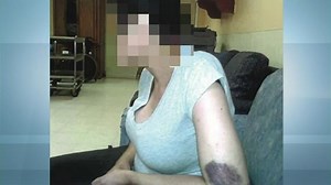 Three Families Sue Staff Members at Group Home in Bronx, Claiming They Abuse Residents