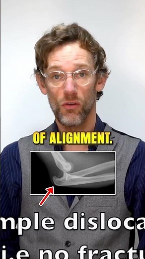 Two Types of Elbow Dislocations