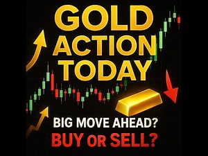 Today Gold Chart