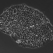 Video: Preparation of Cell-lines for Conditional Knockdown of Gene Expression and Measurement of the Knockdown Effects on E4orf4-Induced Cell Death