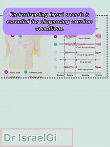 The heart's hidden language. 🫀👂 A simple guide to different heart sounds and the pathologies they indicate. #HeartSounds #Cardiology #MedStudent #NurseLife | House of Medical Skills and Knowledge with Dr IsraelGi