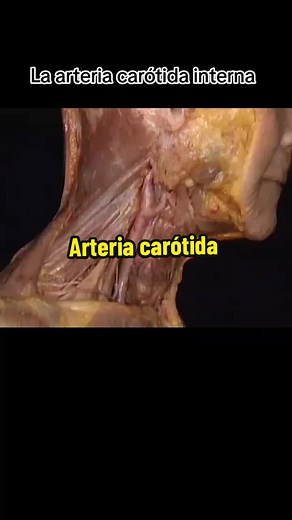 Arteria Carótida Interna: Educación Médica y Anatomía