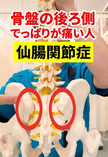骨盤の後ろ側でっぱりの仙腸関節が痛い人！ その理由と解決エクササイズご紹介します✨ ーーーーーーーーーーーーーーーーー 白山整骨院は、「その場しのぎの痛み止めやマッサージではなく、身体の根本から変えたい」あなた様のお役になることをモットーとしています🙌 他ではよくならない、首こり・肩こり・頭痛・腰痛・背中の痛み・ぎっくり腰・坐骨神経痛・膝の痛み・手足のしびれ・自律神経失調症・腱鞘炎・慢性疲労など どこに行っても良くならない方 身体の痛みにお悩みの方は 当院にご相談ください😌 お役に立ててよう頑張ります💪 📍白山整骨院 JR横浜線 鴨居駅より徒歩12分🚶 横浜市緑区白山2-14-27-101 🕗ご予約受付時間 8時30分～11時30分/14時30分～19時 休診日：木曜 日曜 祝日 🗓️予約 045-936-2144 #腰痛 #骨盤矯正 #坐骨神経痛 #ダイエット #股関節