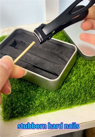 Heavy-Duty Toenail Scissors for Thick Nails | Sharp Stainless Steel Clippers