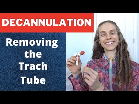 Decannulation: When a Tracheostomy Tube is No Longer Needed