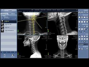Xmaru Chiropractic Viewer | Rayence Digital X-Ray Software for Chiropractors