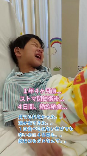 2022.3.3人工肛門閉鎖手術体験談と感情面の苦悩