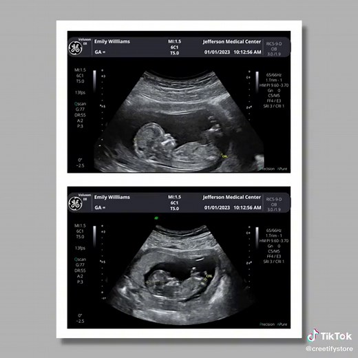 Customized Fake Ultrasound Picture Online