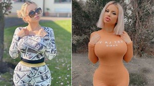 Young lady speaks on spending over N17.6m on surgery to look like Barbie