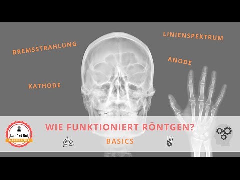 Wie funktioniert Röntgen? Grundlagen kompakt erklärt