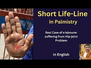 Short Life-Line in Hand- Is it a Sign of Short-Life or Medical Dependency in Palmistry