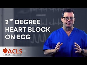 Second Degree Heart Block | ACLS Certification Association