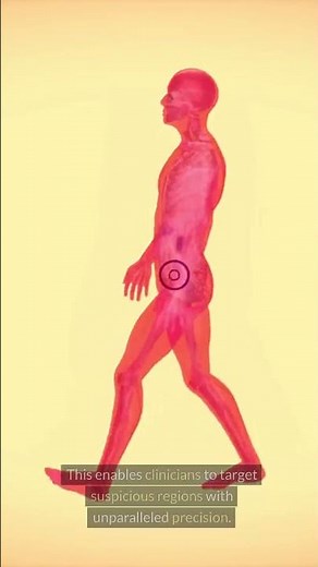 Unveiling the Secrets of MRI-Guided Prostate Biopsy