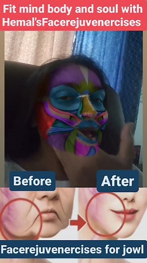 Jowls are not a sign of a medical issue but can feel distressing every time someone sees the excess skin in the mirror. There are a few ways to address jowls with varying degrees of success. Lifestyle changes like weight loss, exercise, and a healthy diet can help. Specific jaw exercises can also tighten jowls Though thin people can also get excess skin along their jawlines, the problem tends to be more prominent in people who are heavier. If you have a lot of extra weight to lose, getting rid o