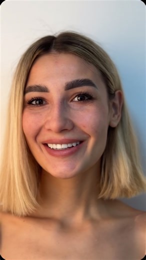 Rumeysa Akman on Instagram: "Yeni bir lamine uygulamasıyla gülüş tasarımı ✨ #laminateveneers #yaprakporselen #smiledesign #gülüşestetiği #smilemakeover #dentistry #smilemakers #beautifulsmile #estheticdentistry"