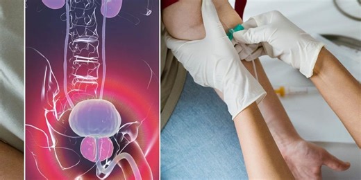 Prostate cancer: Hope for men as breakthrough blood test could revolutionise detection