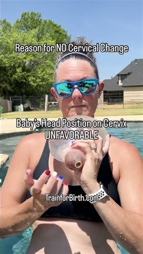 Baby’s Head Position Matters