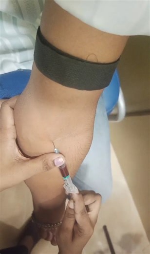 Blood Sample Collection Using Syringe | Phlebotomy Basics 💉