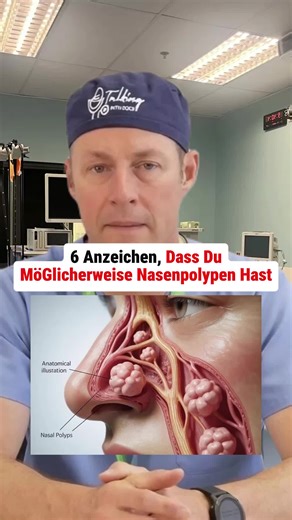 6 Anzeichen, dass du möglicherweise Nasenpolypen hast #Nase #Polypen #Nasenatmung #Gesundheit 6 Anzeichen für Nasenpolypen erkennen Entdecke die 6 Anzeichen für Nasenpolypen und erfahre, wie du deine Nasenatmung verbessern kannst. #Nase