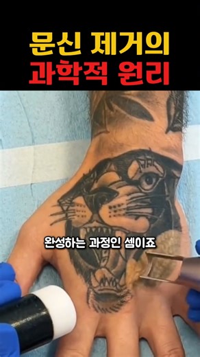 Where Does Tattoo Ink Really Go When You Erase It? #tattooremoval #lasertreatment #humanscience #...